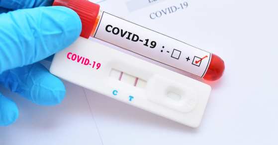 covid coronavirus teste rapido
