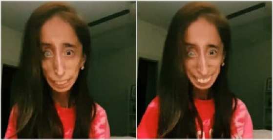 LIZZIE VELASQUEZ 