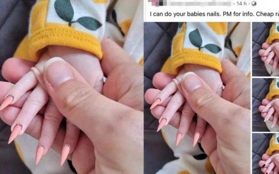 UNHA POSTIÇA EM BEBE