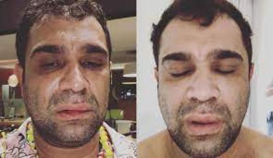 EX PANICO EVANDRO