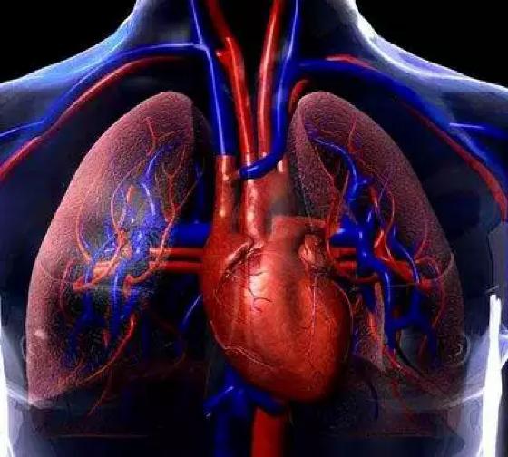 ACIDENTE CARDIOVASCULAR