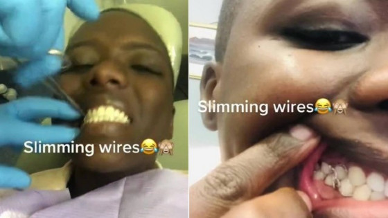 africana prende os dentes para perder peso