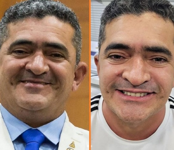 ELIZEU NASCIMENTO HARMONIZAÇÃO