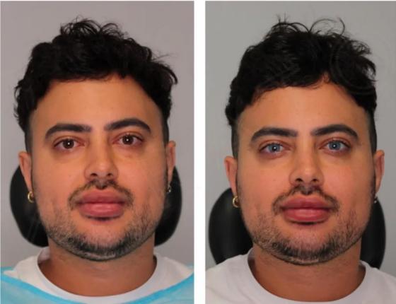 Homem mudar cor dos olhos