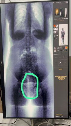 Drogas nos pres&iacute;dios