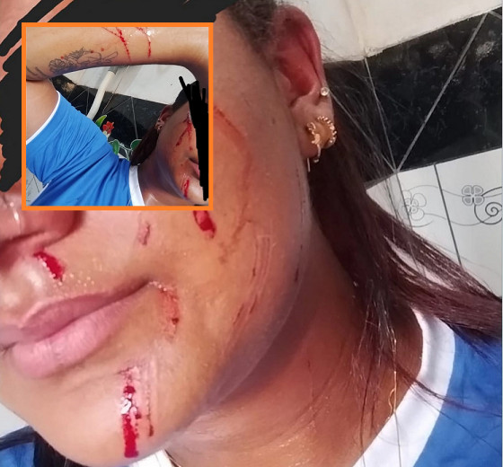 jovem sofre tentativa de estupro