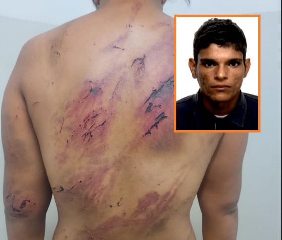 Mulher brutalmente espancada