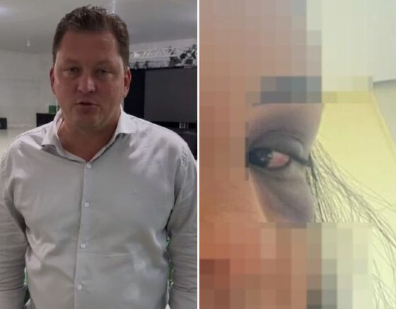 Candidato espanca mulher