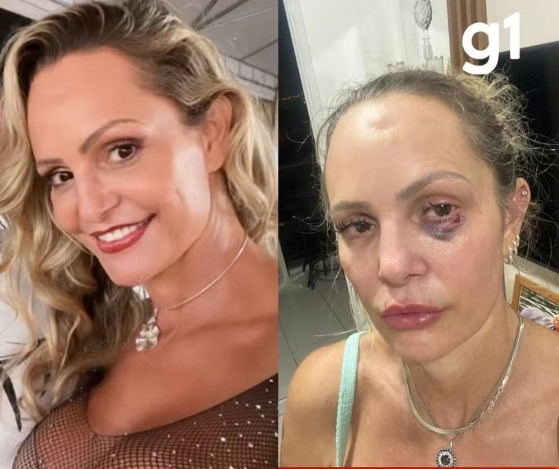 Personal denunciou ter sido espancada por ex-companheiro.