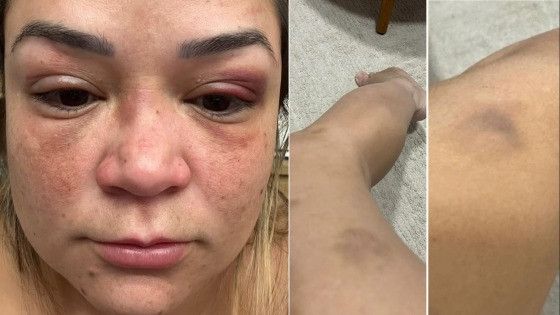 daline sinop agressão 