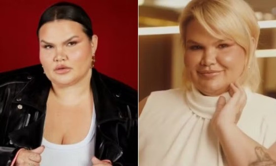 THARIS CARLA ANTES E DEPOIS CIRURGIA.jpg