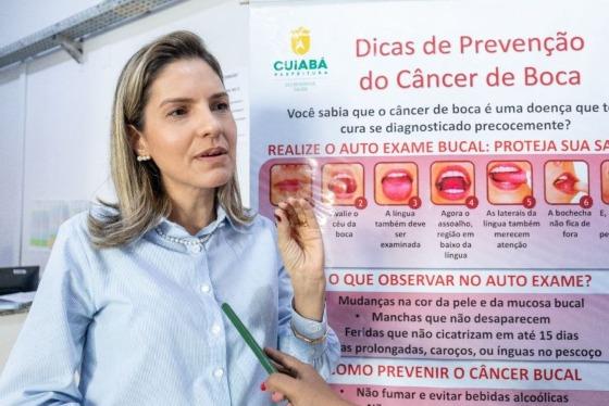 mimo público