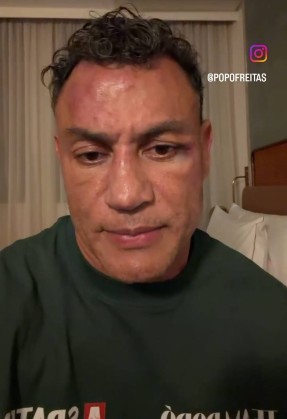 Popó