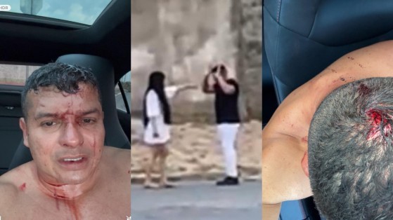 MONTAGEM WALTINHO AGREDIDO.JPG
