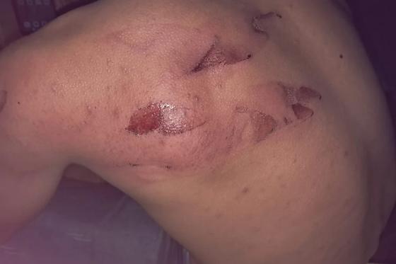 TRABALHADOR AGREDIDO