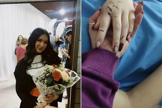 JOVEM ESFAQUEADA ACORDA DO COMA