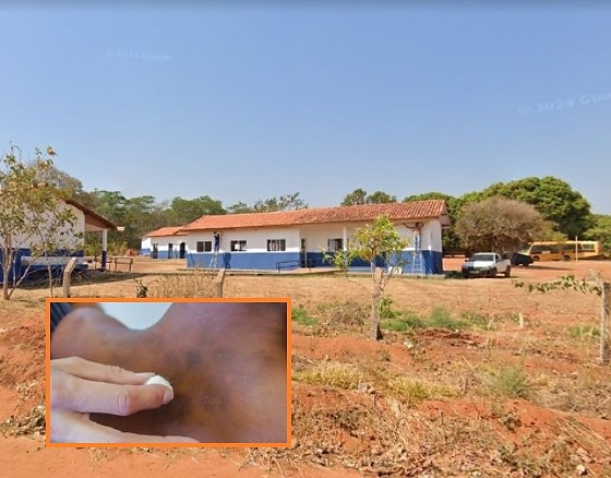 Um aluno da Escola Municipal Professora Elba Xavier Ferreira, no distrito de Água Fria, em Chapada dos Guimãraes, testou positivo.