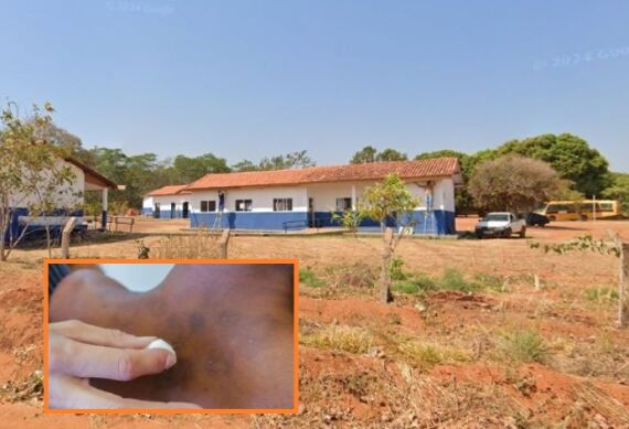 Um aluno da Escola Municipal Professora Elba Xavier Ferreira, no distrito de Água Fria, em Chapada dos Guimãraes, testou positivo.