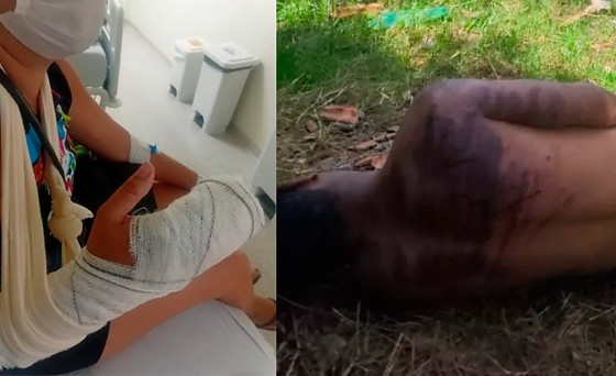 Tentativa de feminicídio e save em cba 