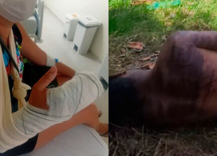 Tentativa de feminicídio e save em cba 