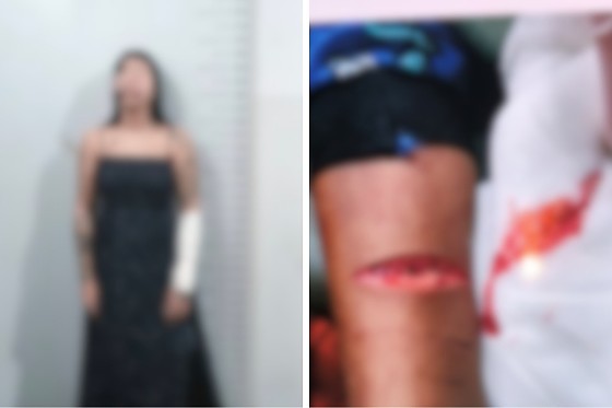 MULHER QUE CORTOU O FILHO .jpeg