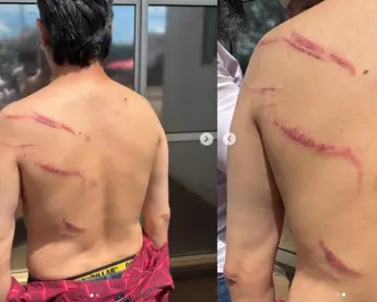 vereador do PT agredido