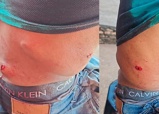 Homem é baleado por casal em motocicleta em Cáceres 