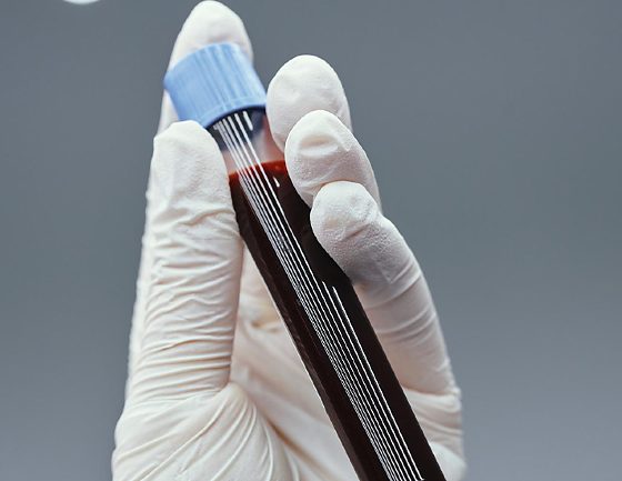 Coleta de DNA