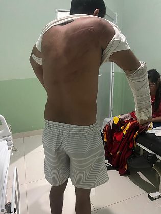 Tortura e sequestro