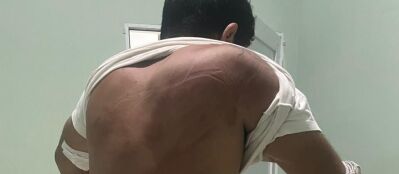 Tortura e sequestro