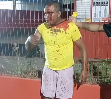 Homem mata mulher com 16 facadas em chapada.