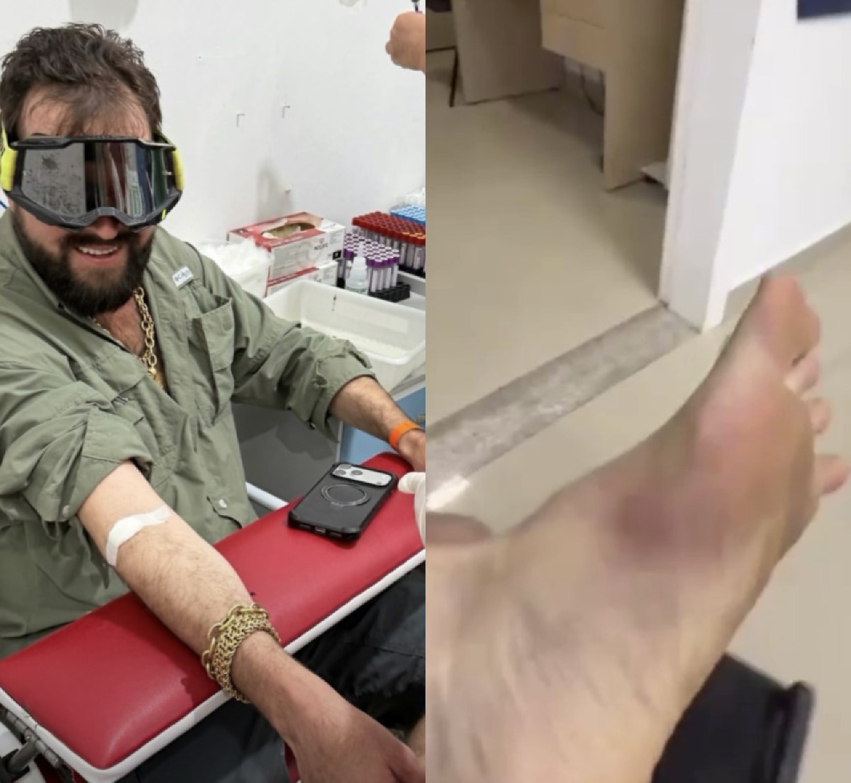 Influenciador AgroTaigo é picado por cobra em Sinop, Mato Grosso