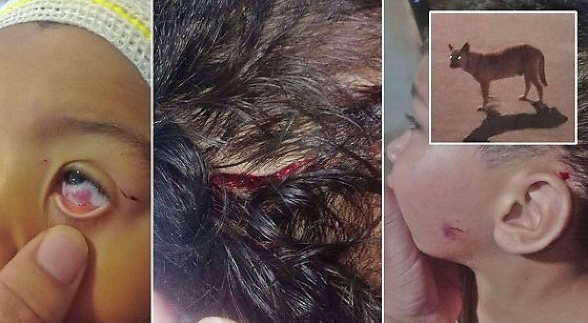 Criança de quatro anos fica ferida em ataque de cachorro em Nova Mutum