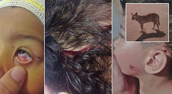 Criança ataque cachorro